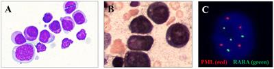 Frontiers Case Report Identification Of A Novel LYN LINC01900